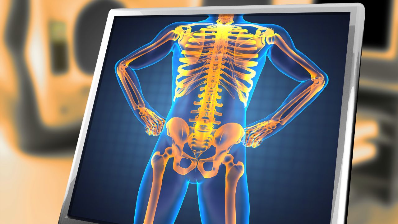 جراحی تومور استخوانی جراحی تومور استخوانی