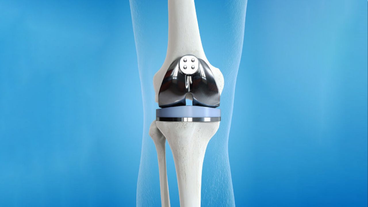 جراحی تومور استخوانی جراحی تومور استخوانی