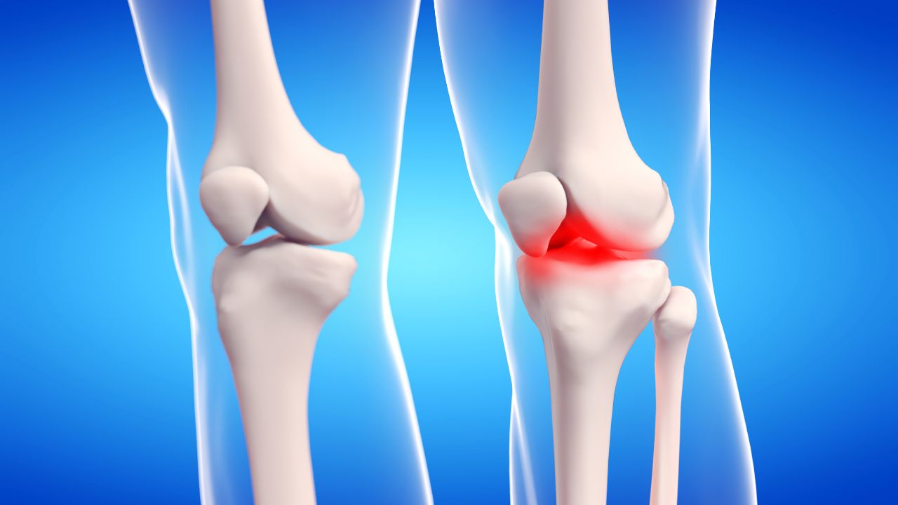 جراحی تومور استخوانی جراحی تومور استخوانی