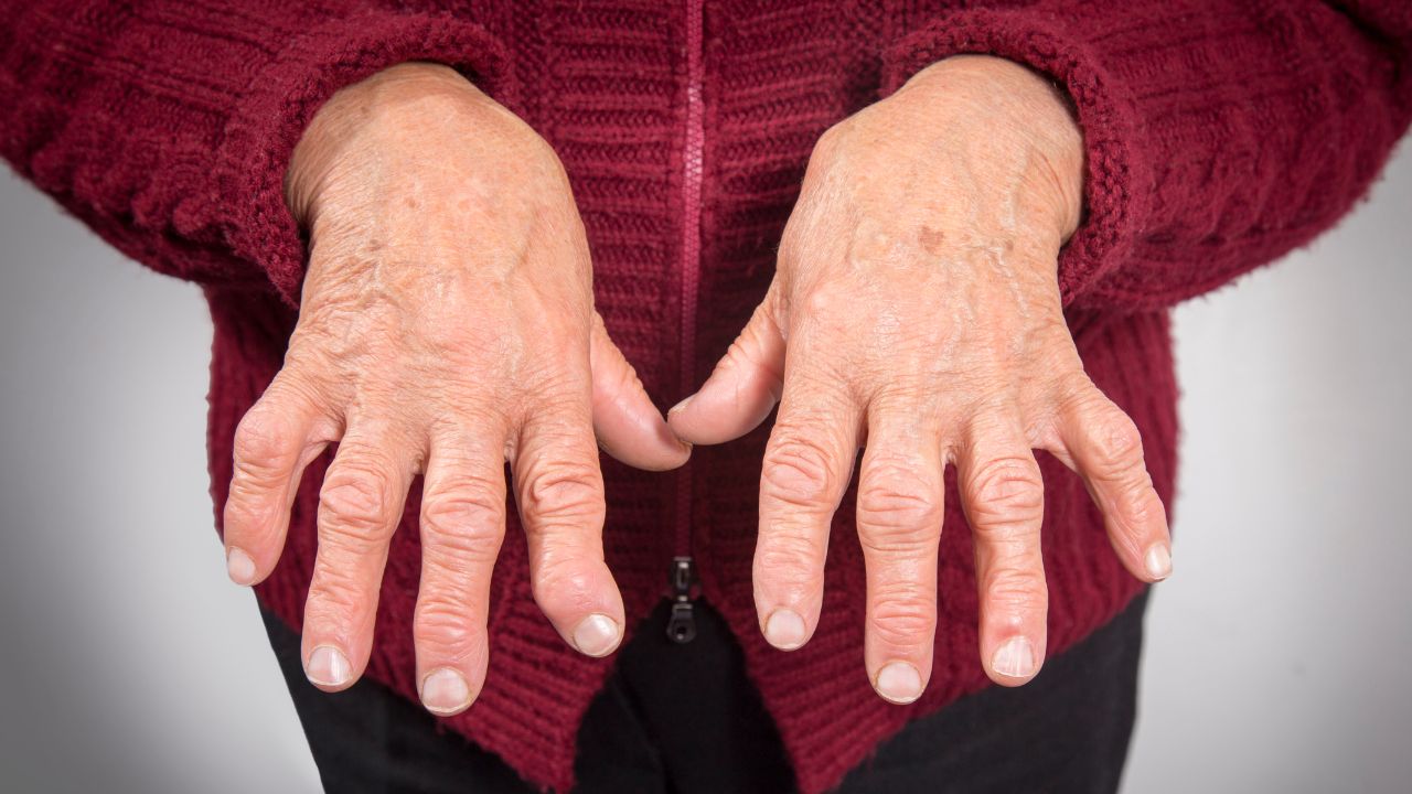 جراحی تومور استخوانی جراحی تومور استخوانی